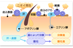 体臭の原因