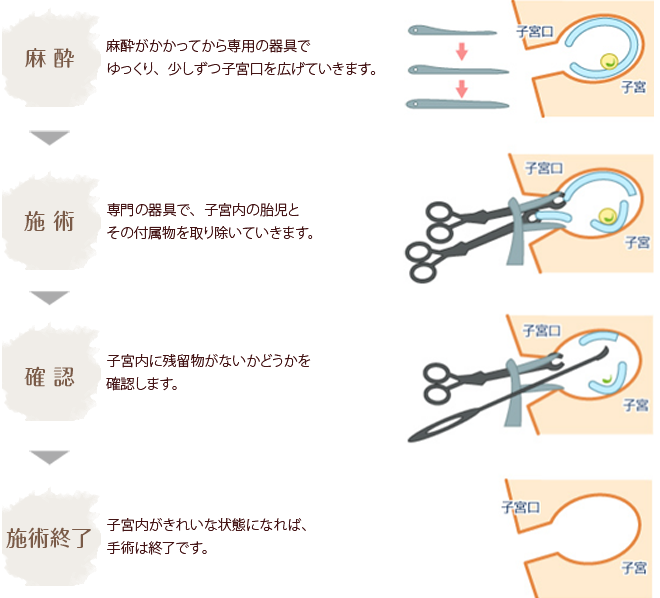 中絶の方法